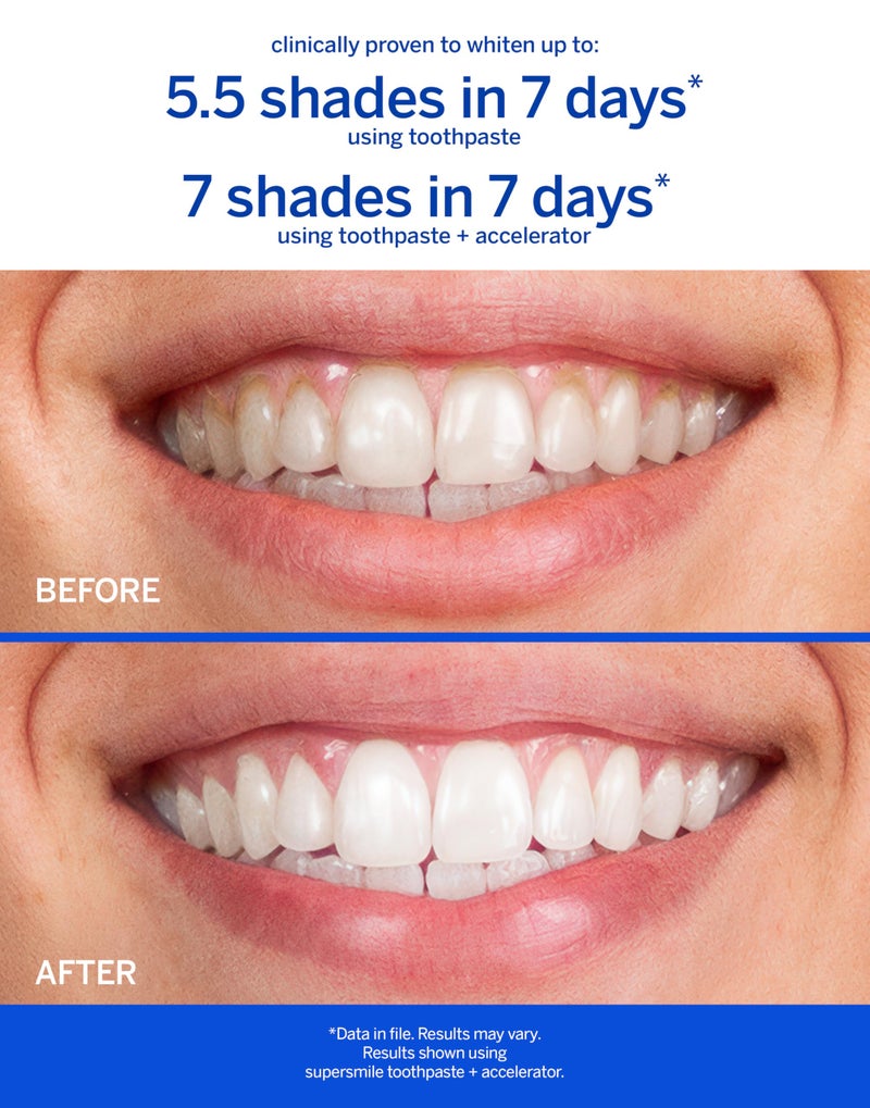 Supersmile Professional Toothpaste (4.2 oz, Cinnamon) - Image 3